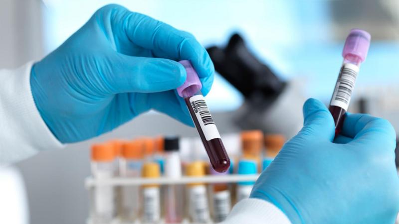 Two possible Ebola cases in Brazil ruled out as patients test negative