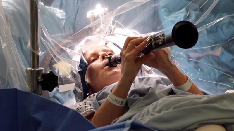Watch: Woman with Parkinson's plays clarinet during brain surgery