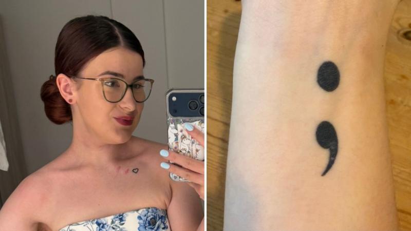 The tattoo on my arm is now on my tongue after cancer treatment