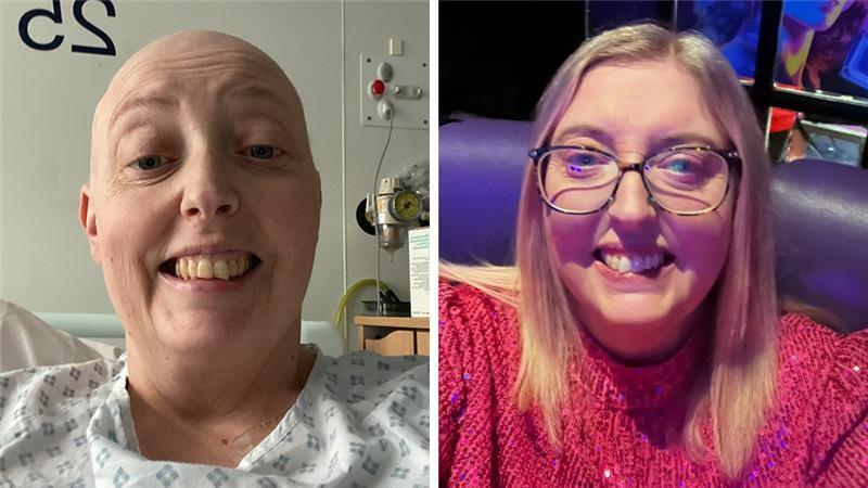 Side-by-side selfies of Jodie. On the left she is bald and in a hospital gown. On the right she has blonde hair and is wearing glasses.