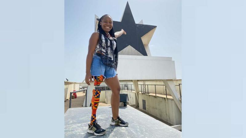 'My prosthetic leg represents my love for this country'