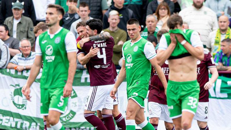 Hibs lost to League One Kelty Hearts on Saturday