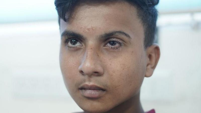 How a Diwali cracker gun in India went from social media craze to blinding children