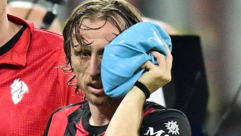 Broken cheekbone but Croatia back Modric for World Cup