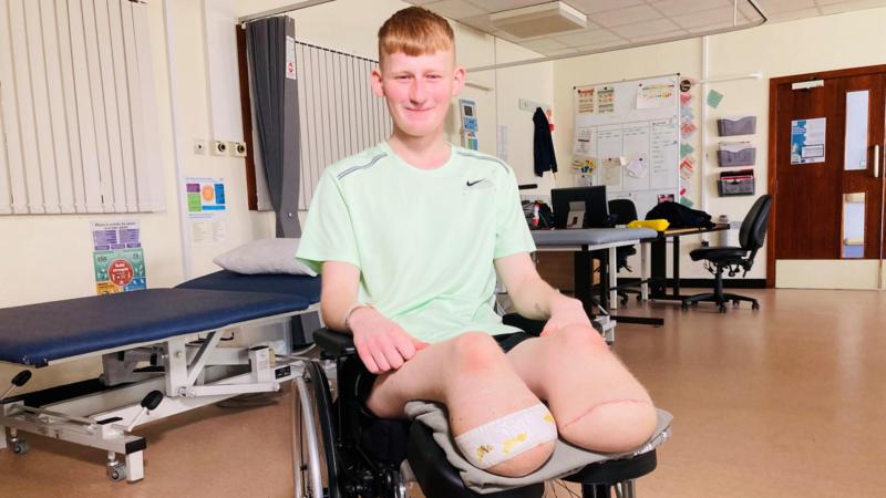Teenager who lost his legs in crash will 'never forgive' driver