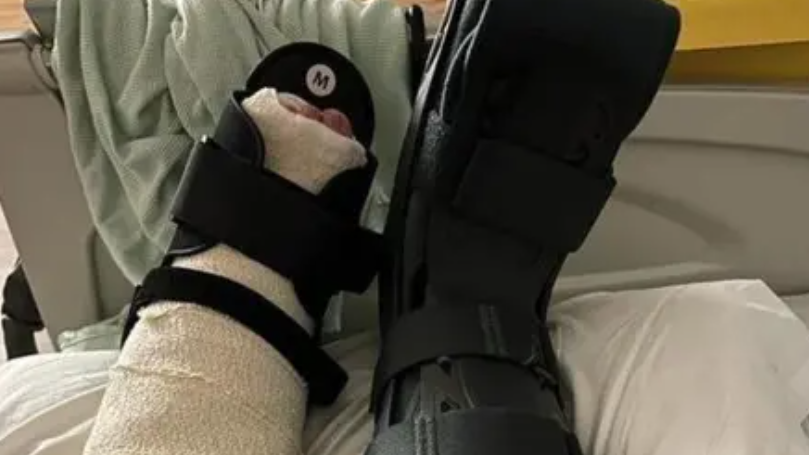 A  broken ankle wrapped in bandages and in a black boot