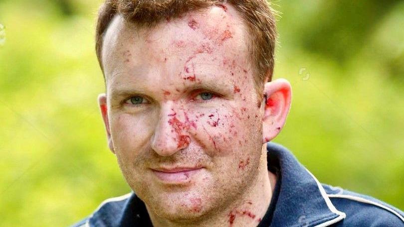 Mr Lait smiles at the camera. He has cuts on one side of his face. He has short red hair.