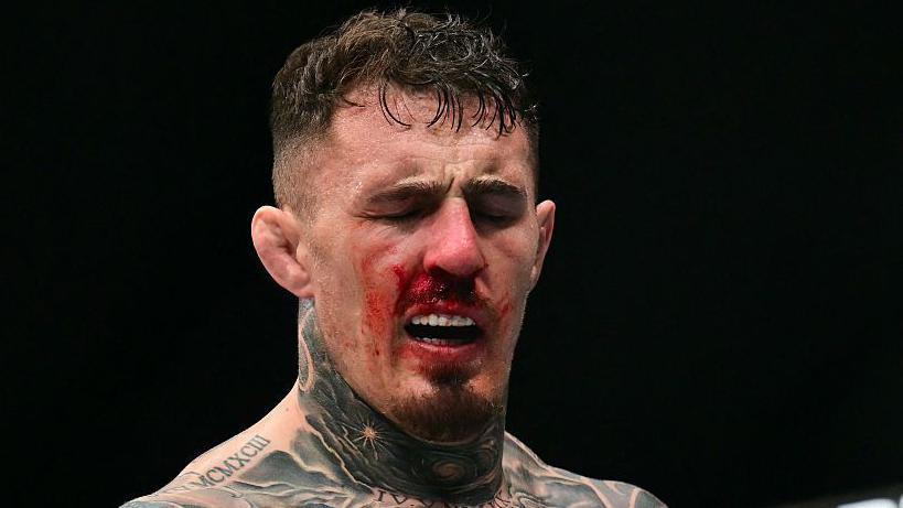 Tom Aspinall blinks in pain during a UFC fight