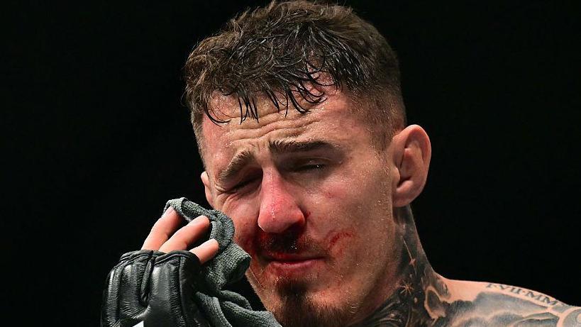 Tom Aspinall holds a cloth to his eye