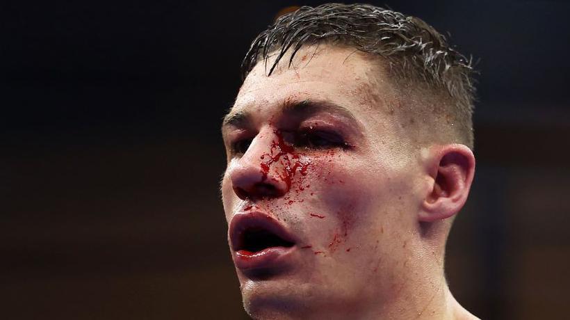 Blood pours from Chris Billam-Smith's face