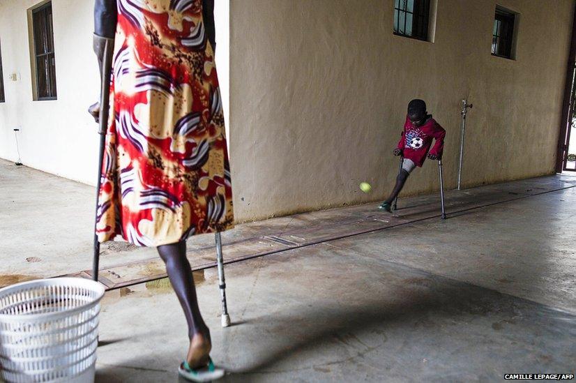 Seven-year-old amputee Deng plays with a ball at the Rehabilitation Centre of Juba, South Sudan