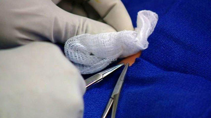 A doctor demonstrates how a circumcision is done on a doll