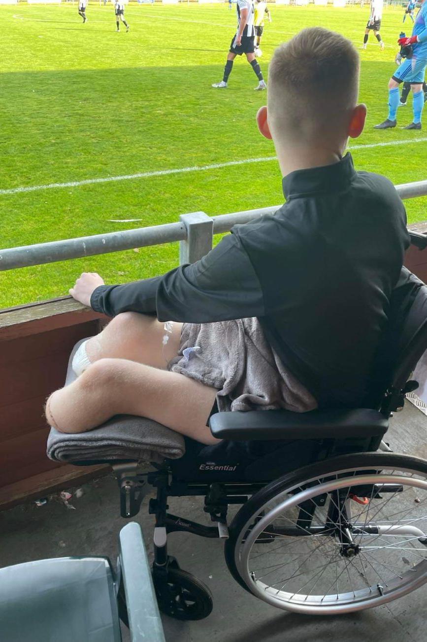 Adam Golebiewski in a wheelchair watching his team play football from the sidelines, both his legs amputated below the knee.