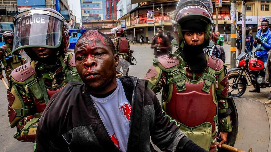 Riot police help a protester from being beaten by business operators during a demonstration over police killings of people protesting against Kenya's proposed finance bill 2024/2025 in Nairobi. (