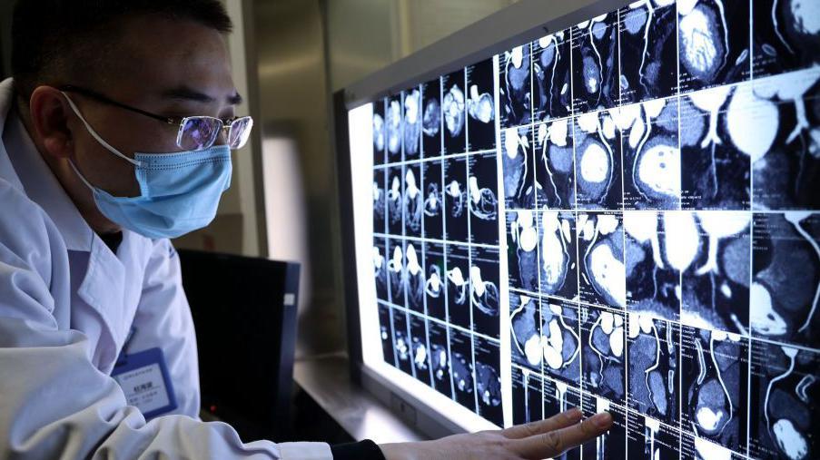 A doctor examines CT scans