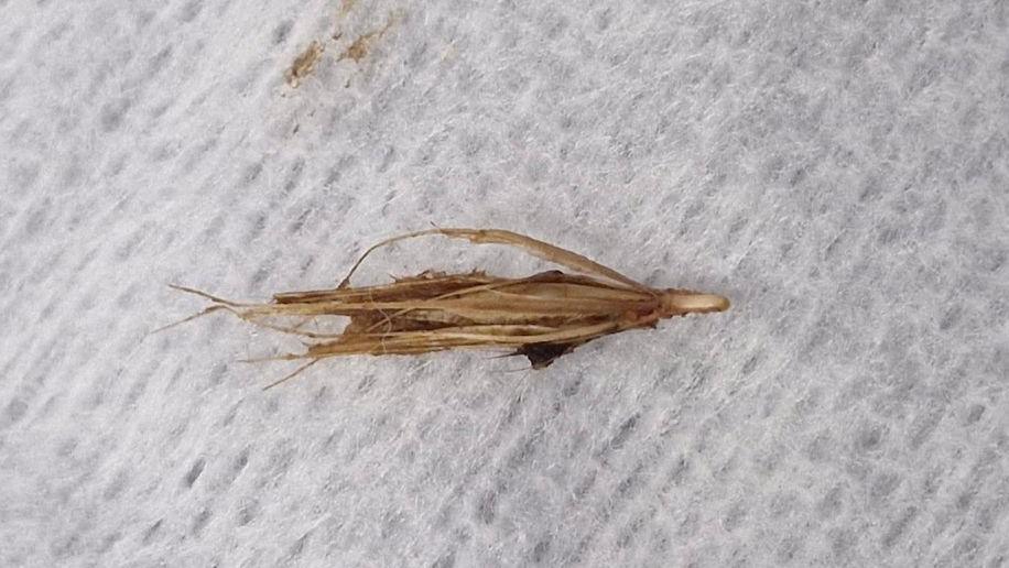 A grass seed which was found lodged in the ear canal of Sally's dog. It is brown and appears to be covered in blood.