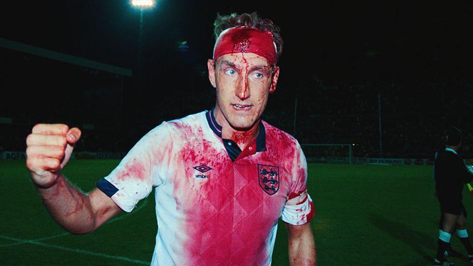 A bloodied Terry Butcher celebrates post match
