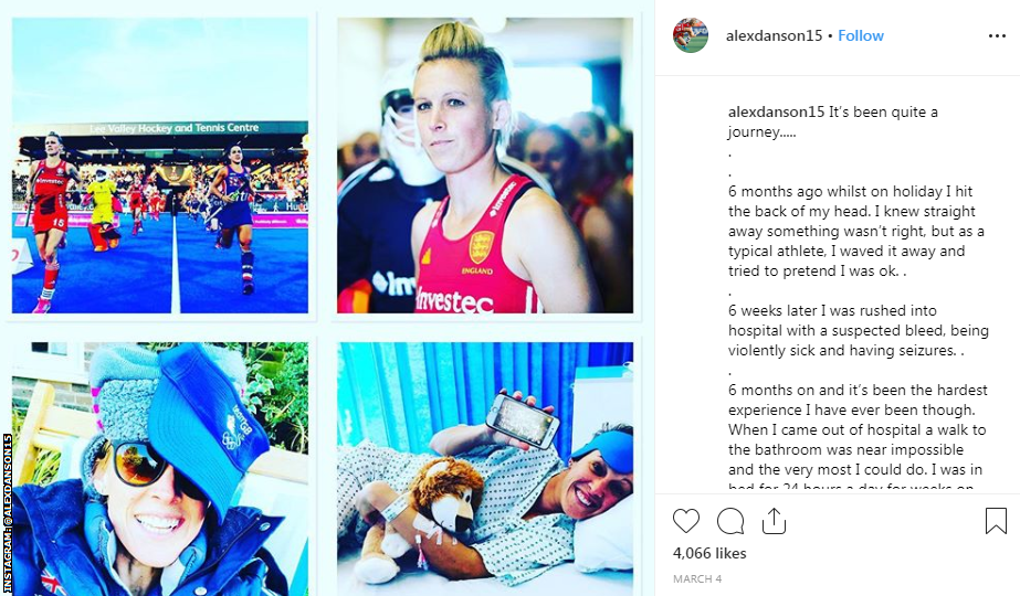 An Instagram post explaining about Danson's injury