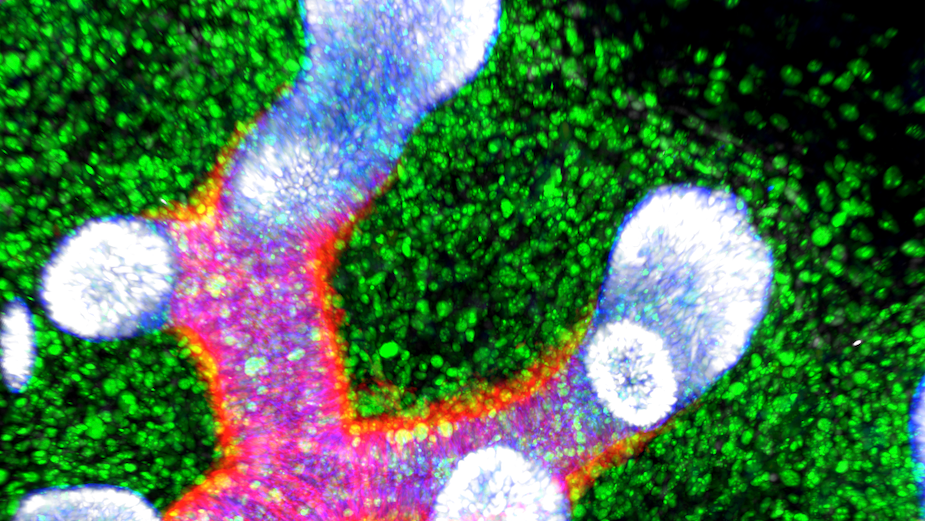 A Human Cell Atlas image of the developing lung, illuminated in orange, purple and green