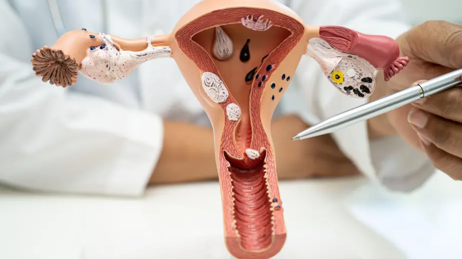 A model of the cervix - the canal joining the vagina and the womb - is visible with a medic pointing at part of it with a pen.