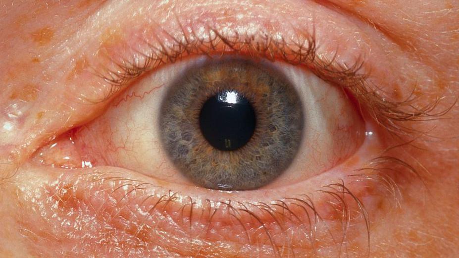 A close-up of someone's blue and brown eye