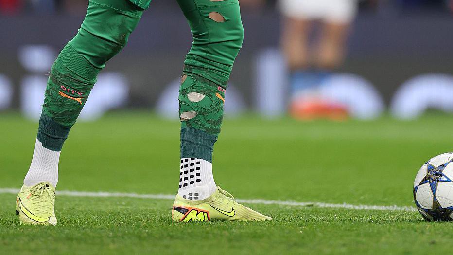James Trafford's legs showing different socks on the top and bottom halves