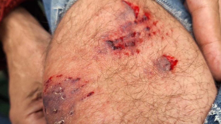 A close-up of Mr Macey's injured knee shows bite marks and blood through his ripped jeans. 