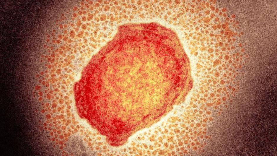 Monkeypox virus particle