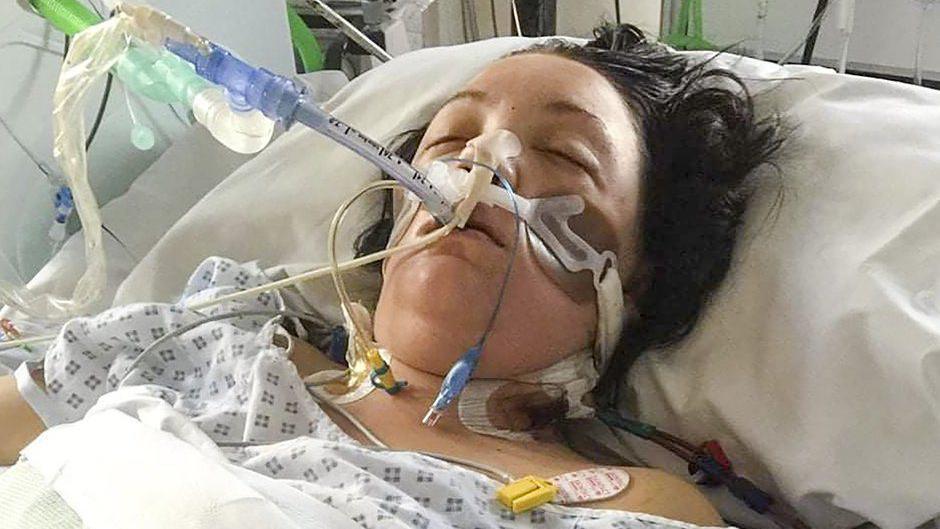 A woman dressed in a hospital gown lays unconscious in a bed. She is hooked up to breathing tubes and wires. 