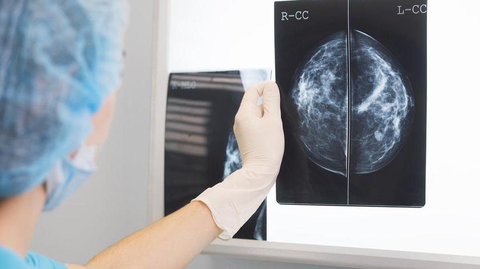 Doctor looking at medical scan for signs of cancer