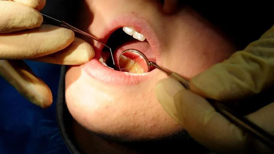 Dentist tools in the mouth of a patient