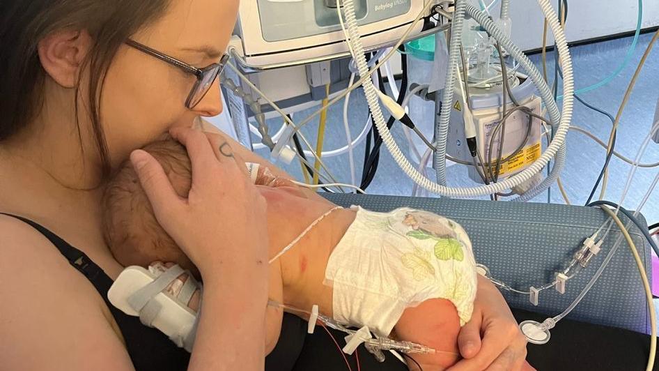 Stacey holding Frankie on her chest at the hospital. He is in just a nappy and has medical tubes connected to him.