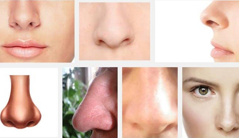 Pictures of white noses