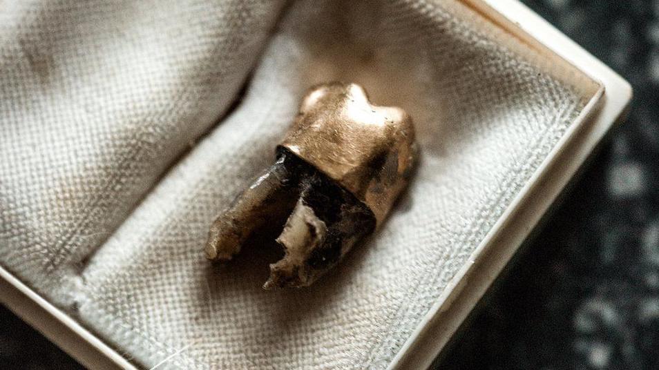 The gold tooth of Patrice Lumumba in a padded box photographed in Belgium in 2016