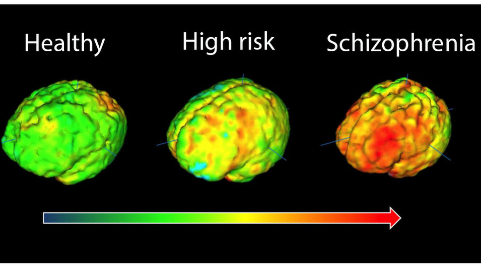 Brain scans