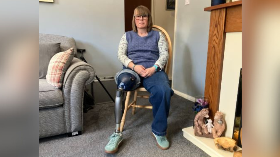Sharon Odell sitting down on a chair in her living room with a prosthetic right leg displayed because she has her jeans rolled-up. She is starting emotionless at the camera.