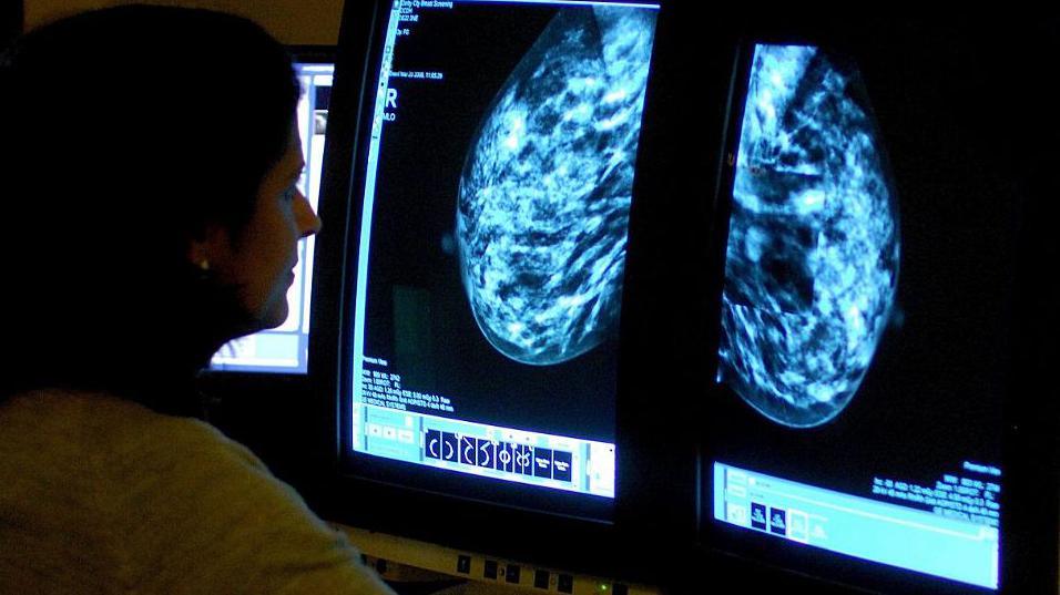 A medical professional analyses mammogram scans on two computer monitors in front of her. 