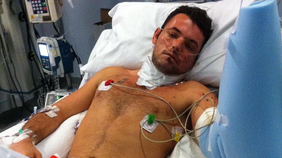 This image shows a man in a hospital bed. His head and body are visible with a number of tubes connected. He has a tube attached to his nose and a bandage around his neck. There are monitors nearby.