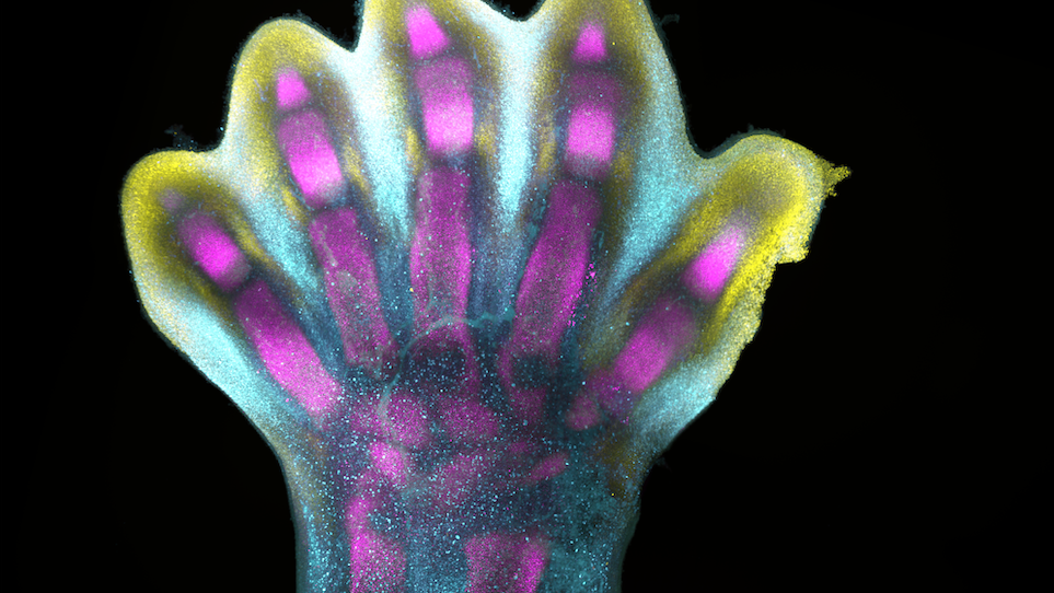 A developing human foot. Dots of different colours are genes building bone, muscle and cartilage