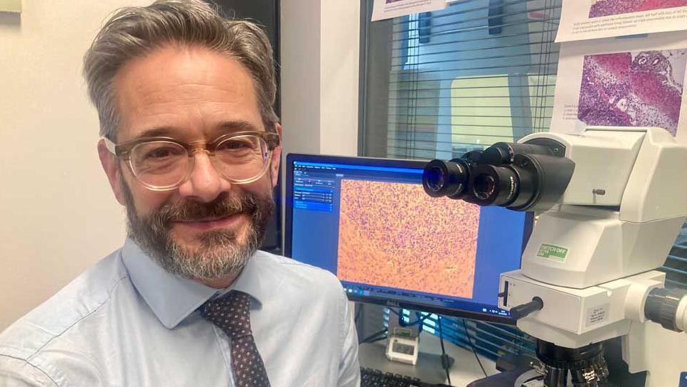 Children’s Brain Tumour Centre of Excellence co-director, Prof Richard Gilbertson, has light brown greying hair and beard and wears brown framed glasses. He is wearing a light blue shirt with a brown spotted tie and is smiling without showing his teeth.