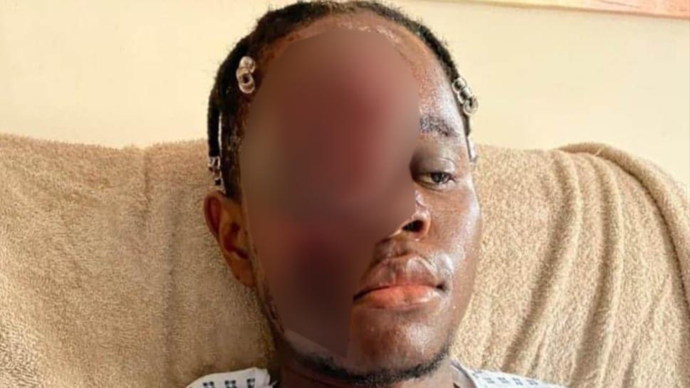 The NHS worker's family released photographs of his injuries