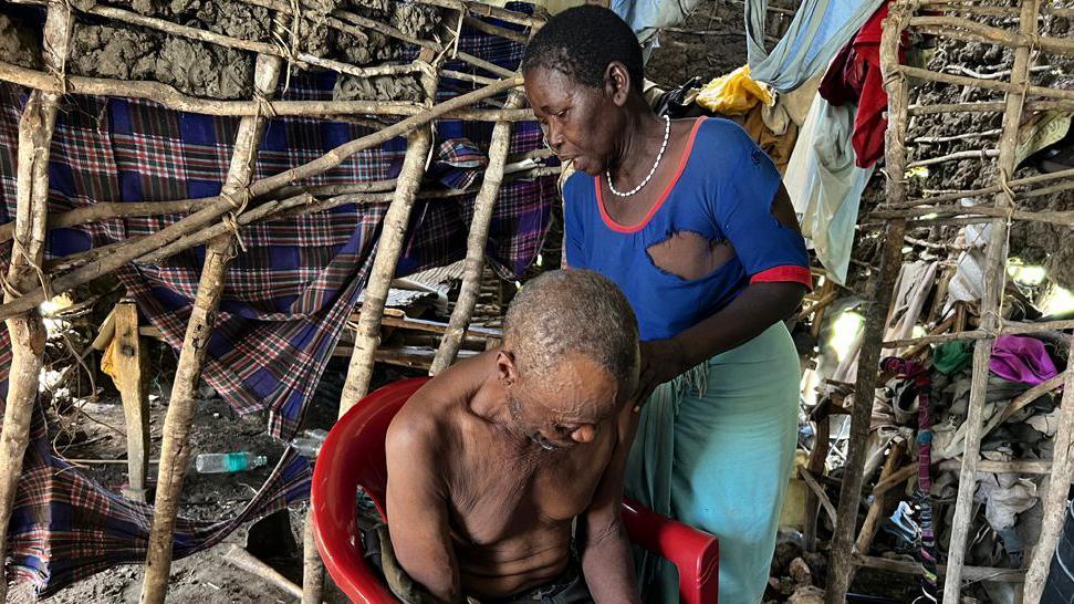 A woman showing the scars on a man's back