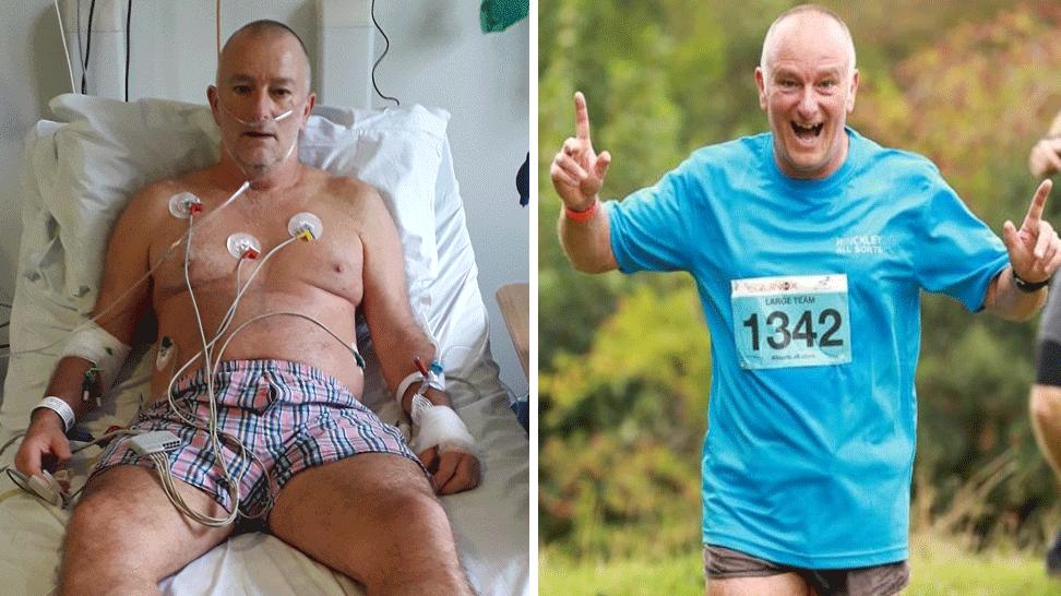 Al Sylvester in two pictures. On the left: On a hospital bed in just his boxer shorts, connected up to wires and a nasal cannula. On the right: Looking joyful during a marathon, his fingers on each hand raised in the air.