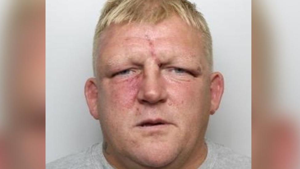 Glynn Leedell has short blonde hair and has a visible red scar on his forehead and what appears to be bruising beneath his right eye.