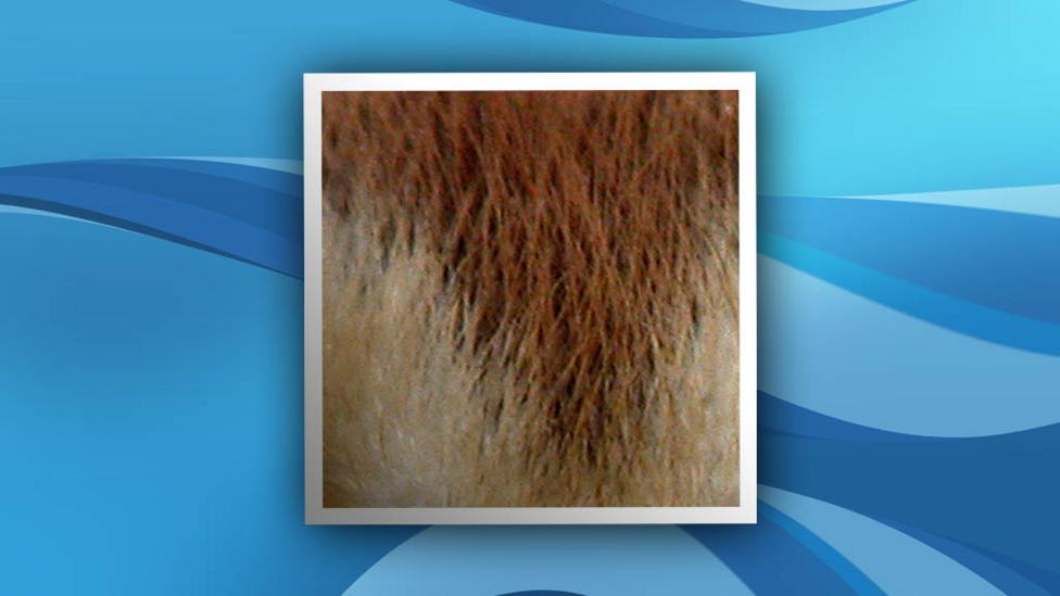 White and Brown hair