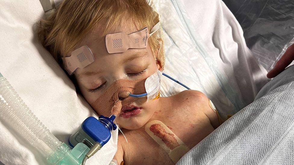 Freddie lying in a hospital bed asleep, attached to tubes in his nose. He has a scar on his chest covered with a dressing