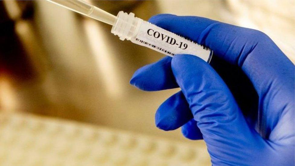 Covid-19 test vial