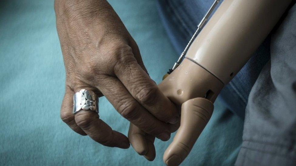 5-year-old Baraka Cosmas (R) from Tanzania holds hands with Elissa Montanati of the Global Medical Relief Fund in the Staten Island borough of New York, September 21, 2015