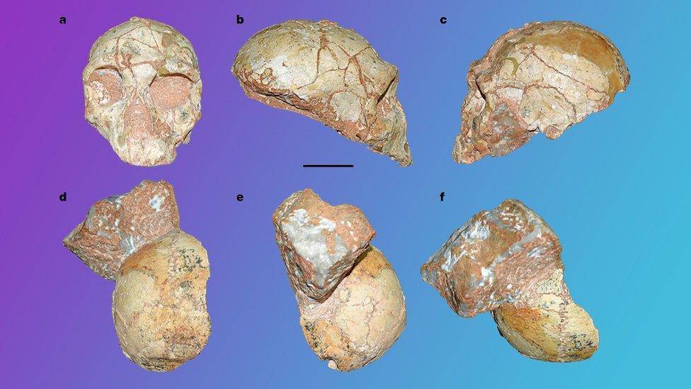 The fossil of a human and Neanderthal skull. (Figure a - c is the Neanderthal skull) (Figure d - f is the human skull)