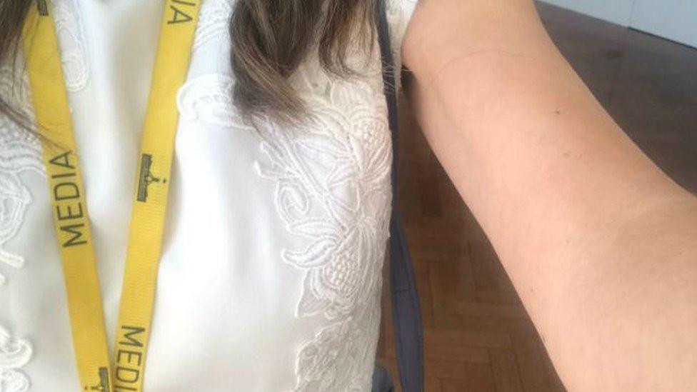 A close up shot of Patricia Karvelas' bare arm which she posted on social media.